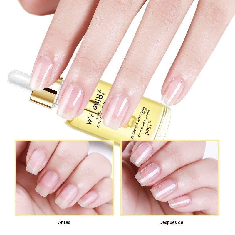 🔥【Compra 1 y llévate 1 gratis】💅 Aceite esencial para cutículas de uñas con gotero