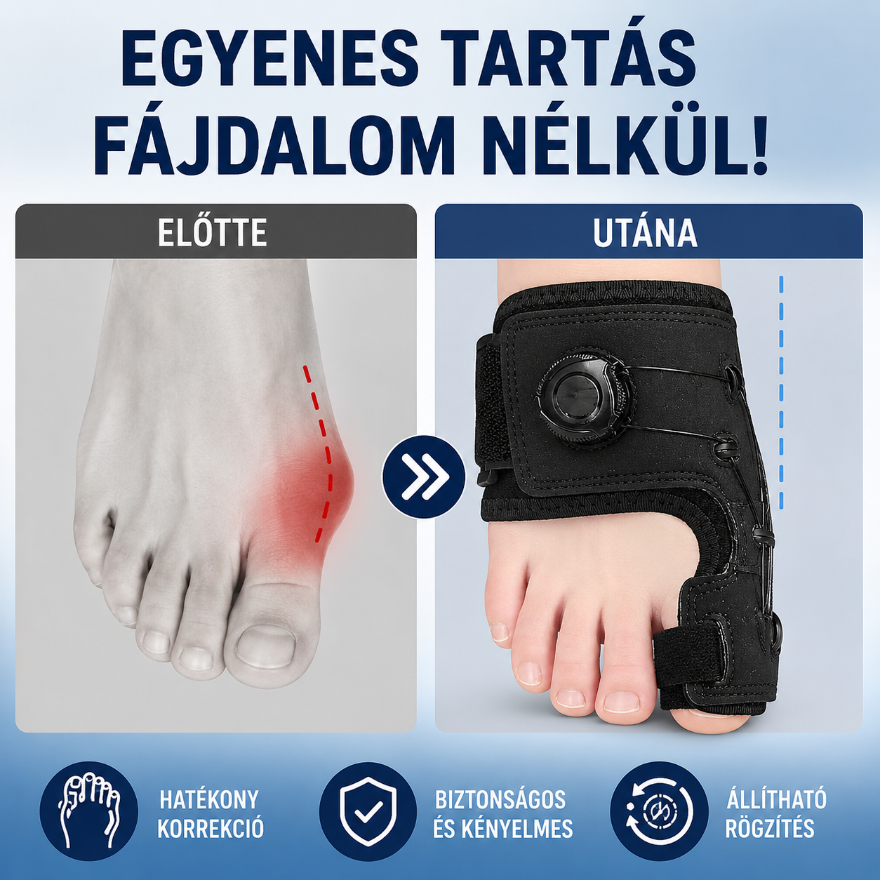 【2 egység 8500 Ft】Professzionális ujjkorrekció állítható gombbal, rögzítő sínnel és ujjszétválasztóval, fájdalomcsillapítás, univerzális méret