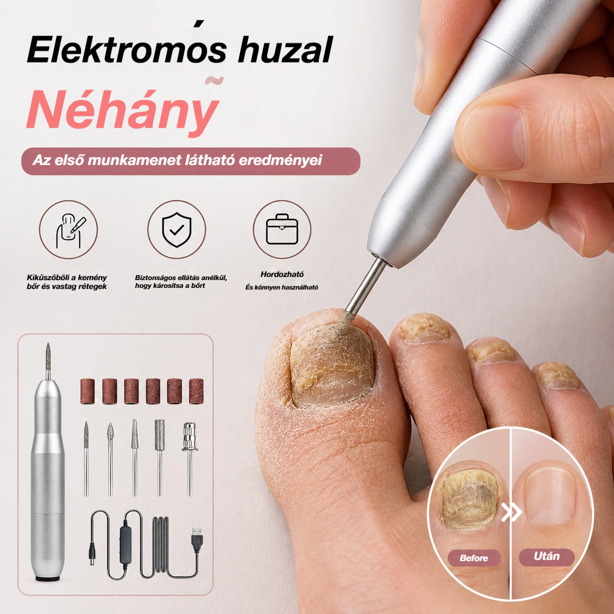 💅👍 Elektromos körömreszelő az onychomycosis kezelésére