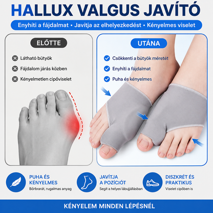 【4 pár】🦶Hallux valgus lábujjvédő